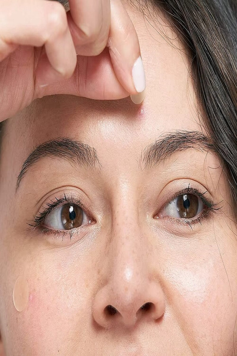 The original hydrocolloid acne pimple patch