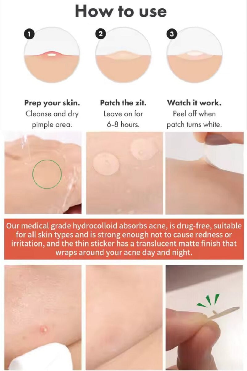 The original hydrocolloid acne pimple patch