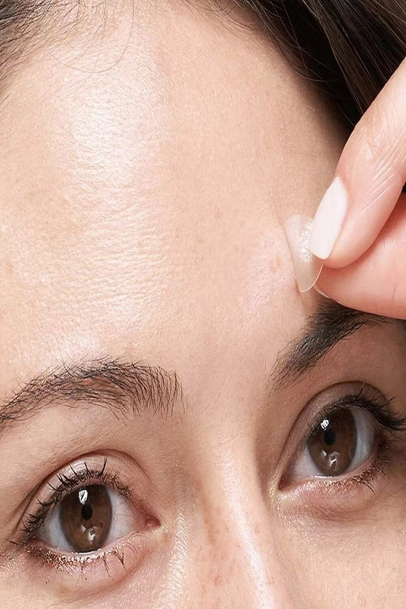 The original hydrocolloid acne pimple patch