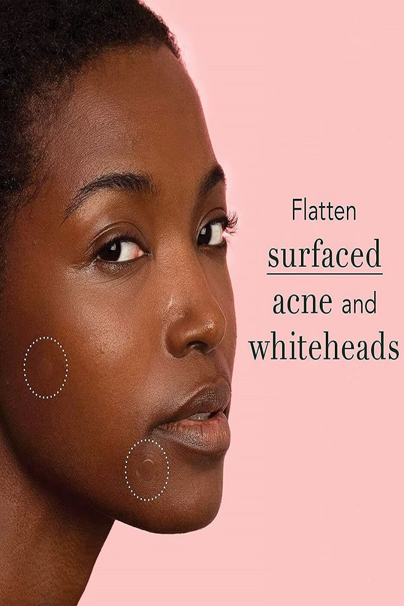 The original hydrocolloid acne pimple patch
