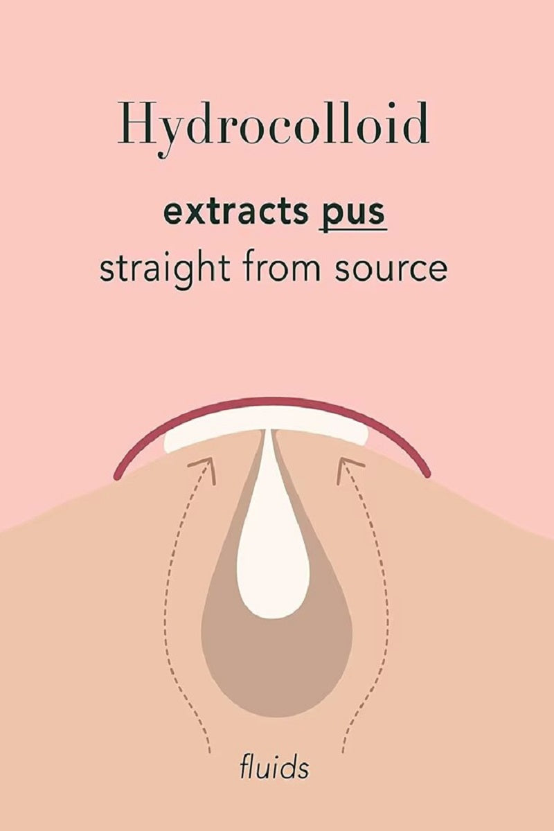 The original hydrocolloid acne pimple patch