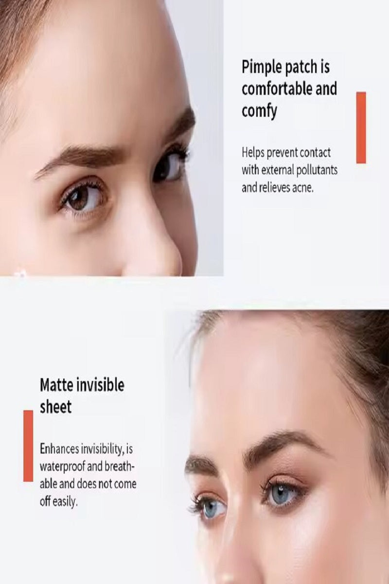 The original hydrocolloid acne pimple patch